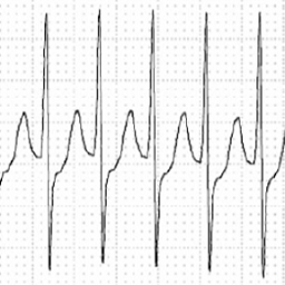 AoiYuki-HeroicHeart icon
