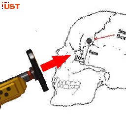 Entropy2A03-Lobotomy_Hammer icon
